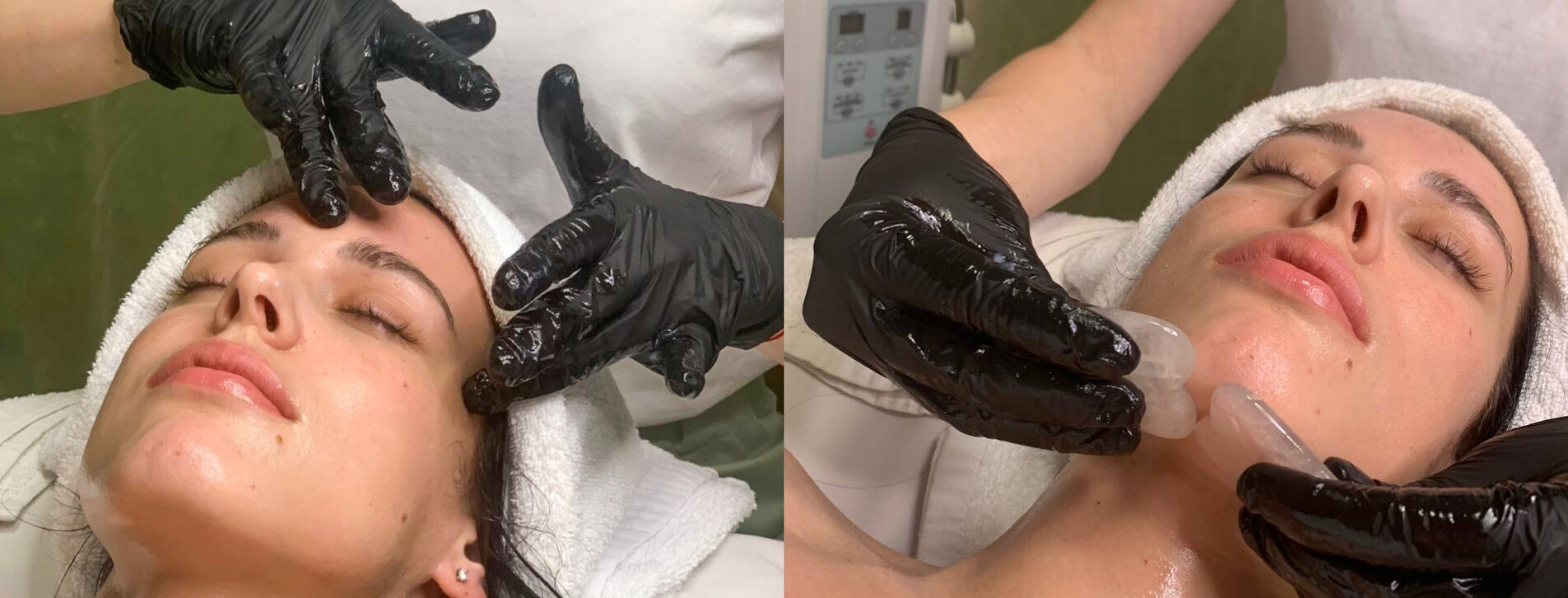 Масаж обличчя гуа-ша в Одесі - 12 Фото 12 - Масаж обличчя гуа-ша