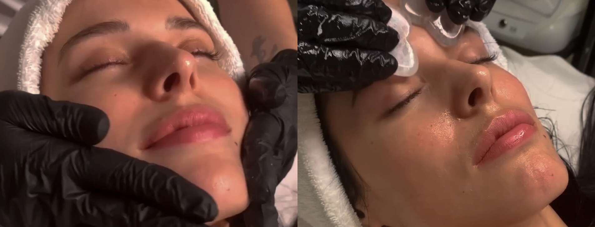 Курс масажу обличчя гуа-ша в Одесі - 22 Фото 22 - Курс масажу обличчя гуа-ша